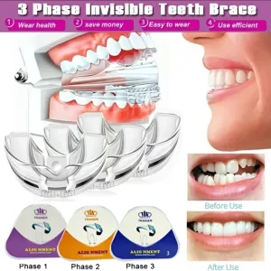3 Stage Overnight Teeth Aligners - 3 Phase Night Guard Braces