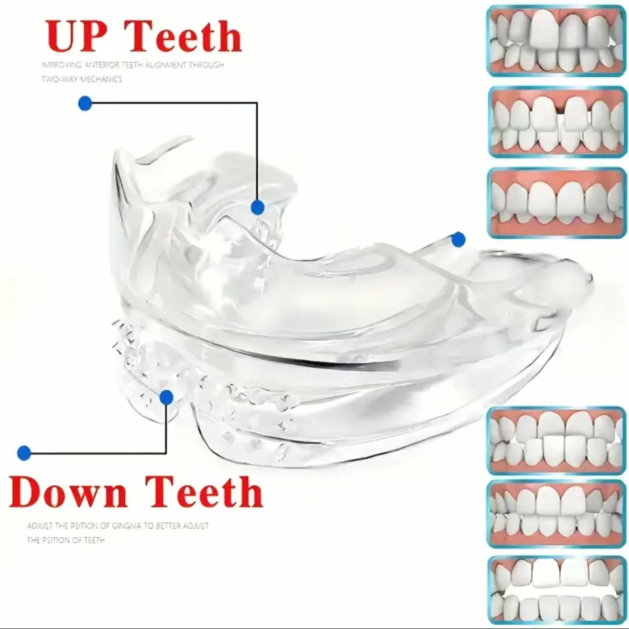 3 Stage Overnight Teeth Aligners - 3 Phase Night Guard Braces