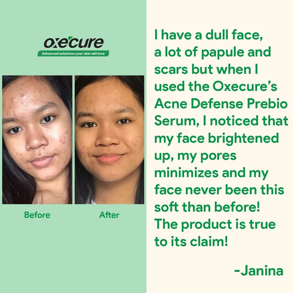 Acne Defense Prebio Serum 5ml