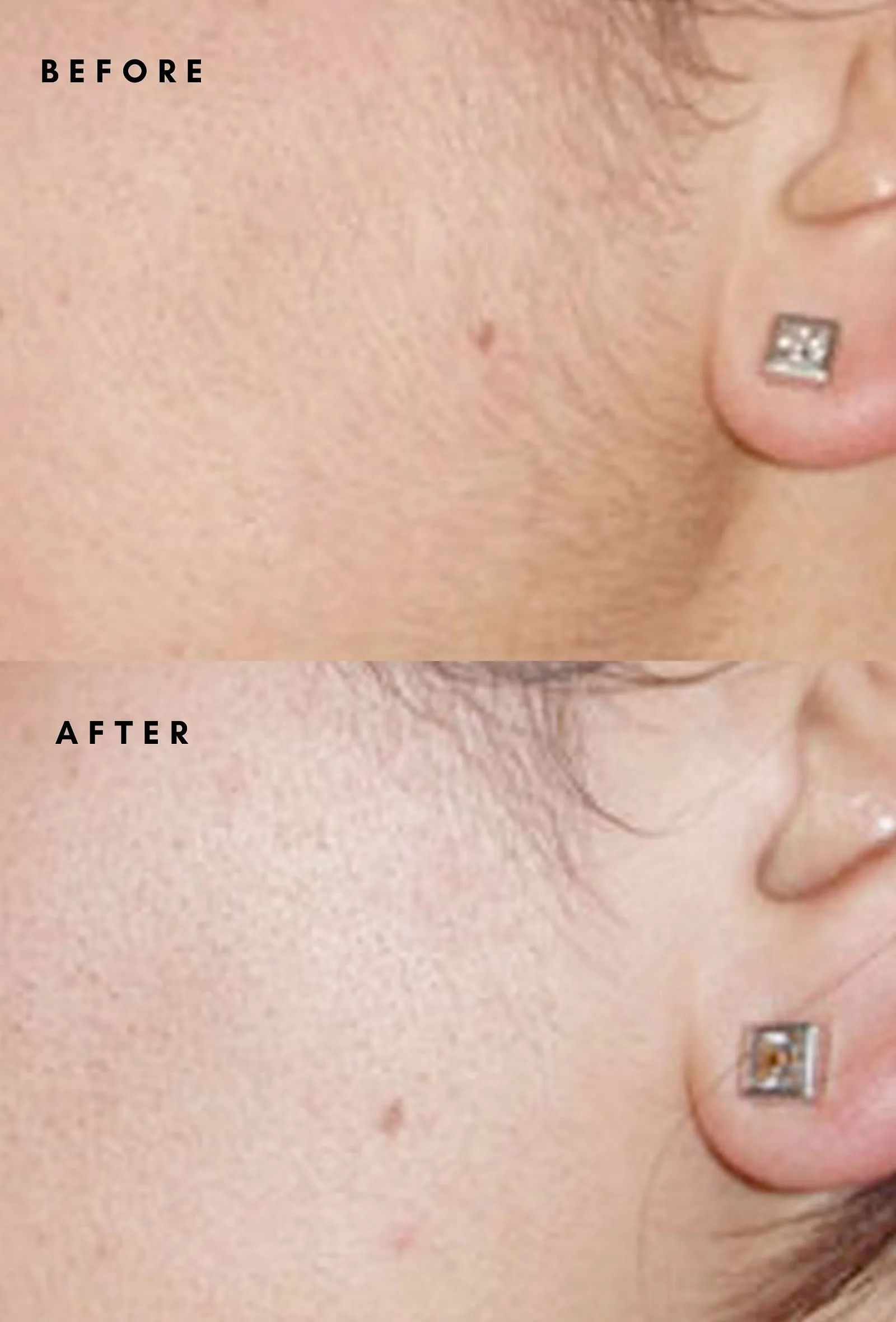 Facial Hair Growth Reducing Scrub